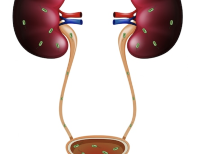 Chronic Kidney Diseases